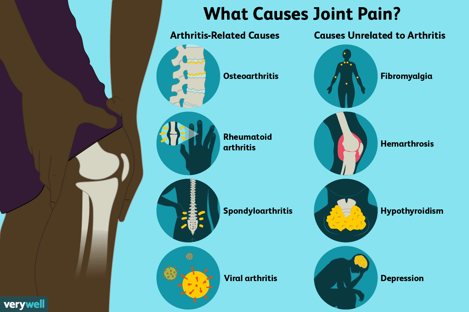 Types of Joint Problems